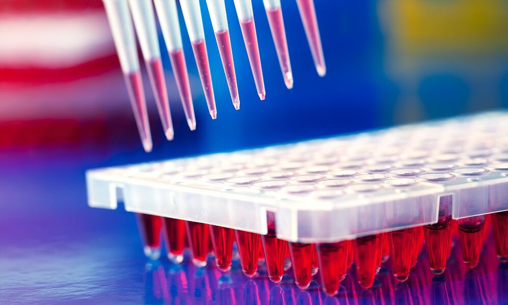 Enzym-immunoassay-bloedtest - een methode voor het diagnosticeren van parasitaire infecties